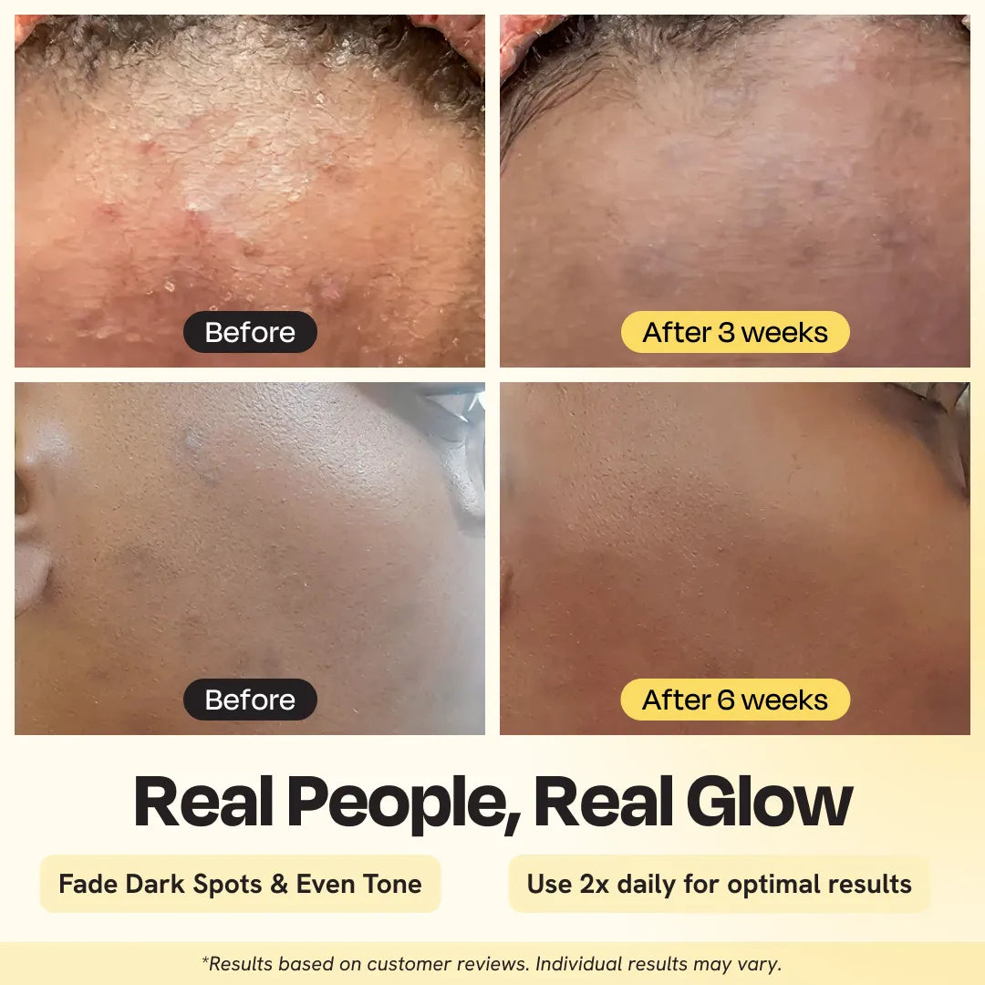 Vitamin C Brightening & Hydrating Face Moisturizer